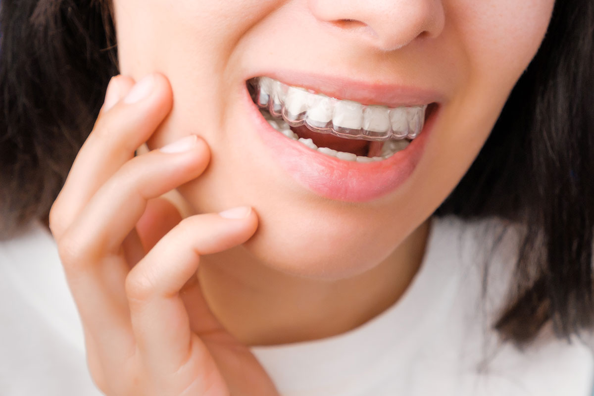 Invisalign®